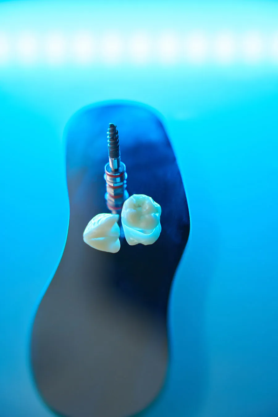 Implante dental de titanio junto a dos coronas cerámicas sobre una bandeja azul